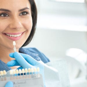 Gülüş Tasarımı (Hollywood Smile)