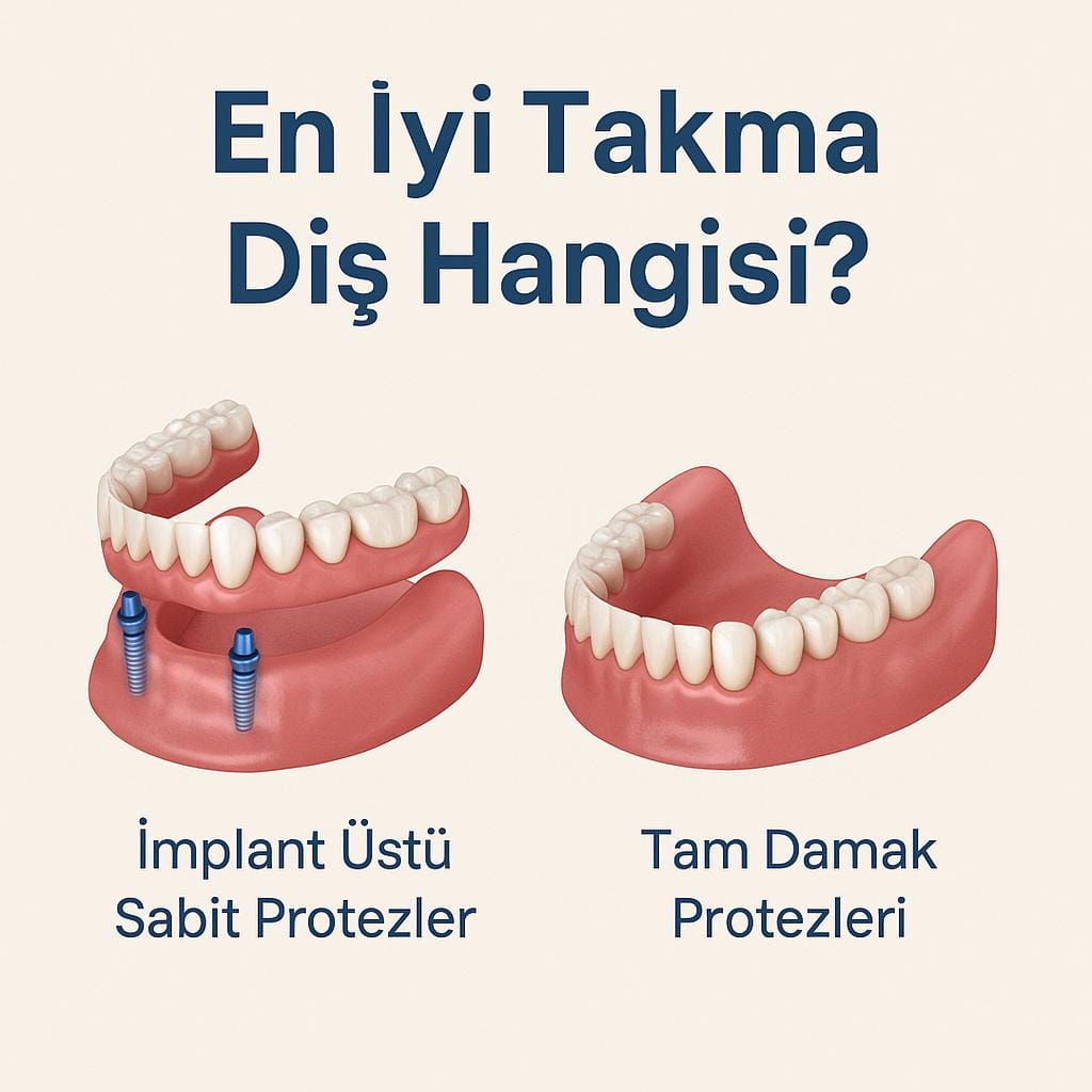 İki farklı takma diş türünü gösteren kare infografik: Solda implant üstü sabit protezler, sağda tam damak protezleri yer alıyor. Üstte büyük puntoyla 
