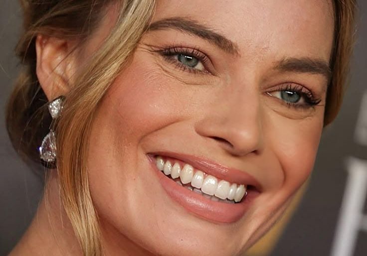 Gülüş tasarımı işlemi yapılan - hollywood yıldızı Margot Robbie