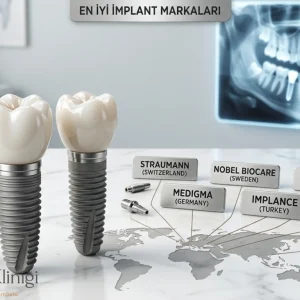 Klinik ortamında Ülkelere göre en iyi implant markalarının görünümü