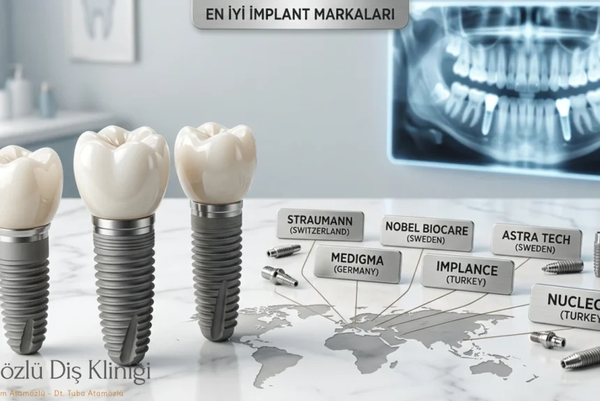 Klinik ortamında Ülkelere göre en iyi implant markalarının görünümü