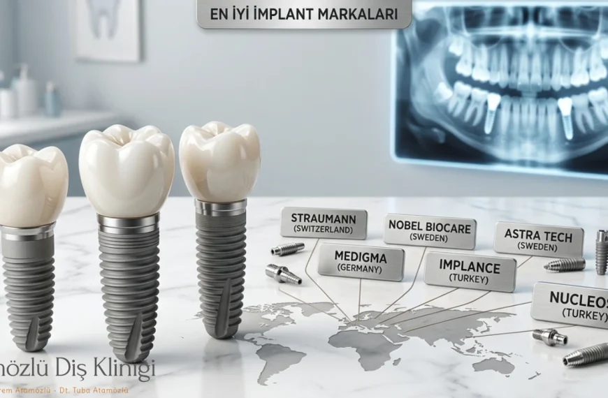 Klinik ortamında Ülkelere göre en iyi implant markalarının görünümü